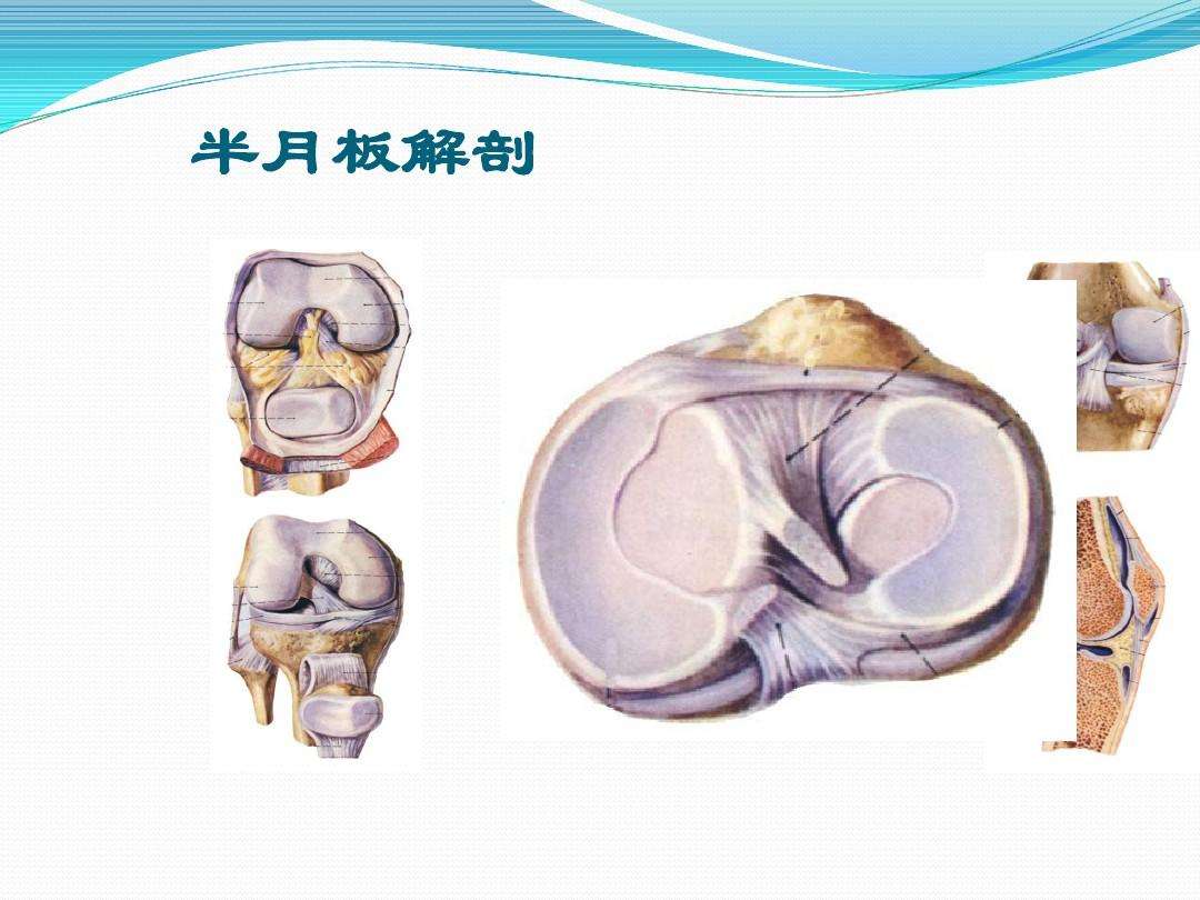 半月板损伤有哪些常见原因