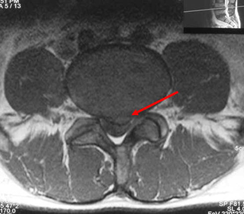 磁共振(MRI)检查