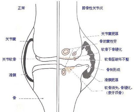 腿疼的原因是什么